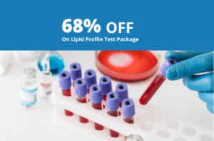 68% Off on Lipid Profile Test Package